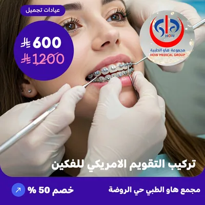 (تركيب التقويم الامريكي للفكين) لدى هاو الطبي حي الروضة