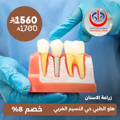  (زراعة الاسنان) لدى هاو الطبي حي النسيم