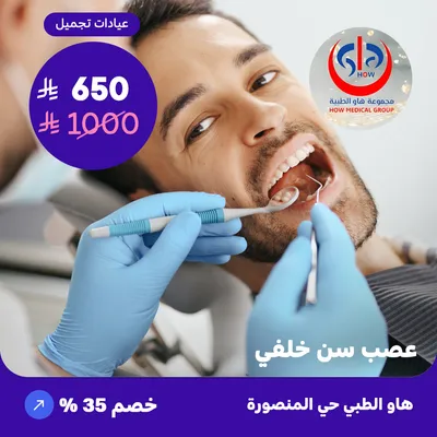 ( احصل على علاج عصب سن خلفي ) لدى هاو الطبي حي المنصورة