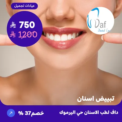 ( احصل على جلسة تبييض الاسنان بالليزر ) لدى داف لطب الأسنان حي اليرموك