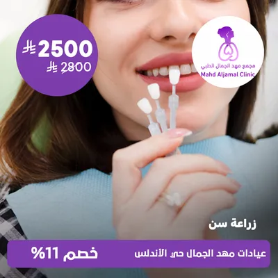 ( زراعة سن ) لدى عيادات مهد الجمال حي الأندلس