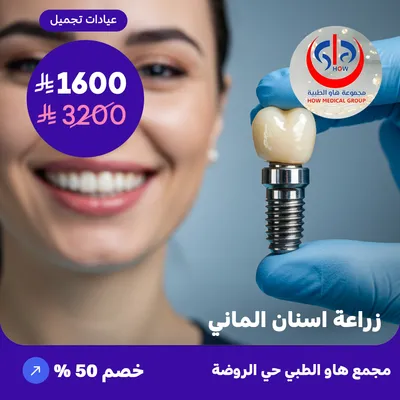 (زراعة اسنان الماني) لدى هاو الطبي حي الروضة 