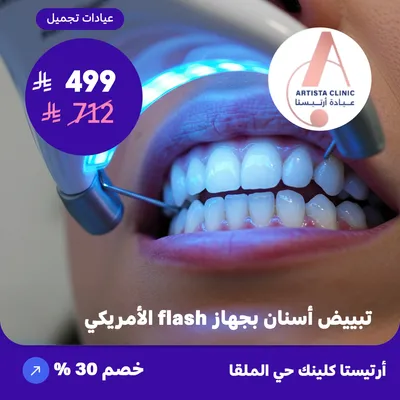 ( احصل على جلسة تبييض اسنان بجهاز فلاش الامريكي ) لدى ارتيستا كلينك حي الملقا 