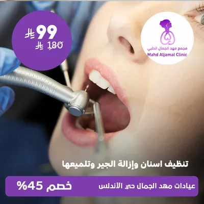 ( جلسة تنظيف أسنان و إزالة الجير و تلميعها ) لدى عيادات مهد الجمال حي الأندلس