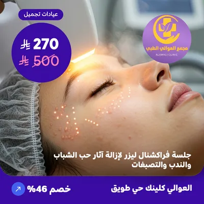  ( احصل على جلسة فراكشنال ليزر لإزالة آثار حب الشباب والندب والتصبغات ) لدى مجمع العوالي حي طويق