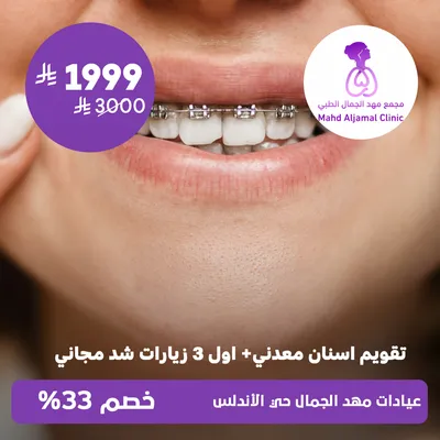 ( تقويم أسنان معدني + اول 3 زيارات شد مجاني ) لدى عيادات مهد الجمال حي الأندلس
