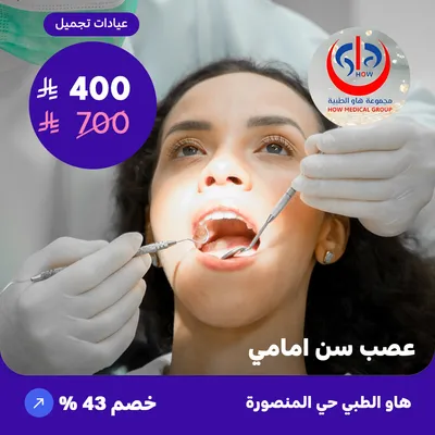 ( احصل على علاج  عصب سن أمامي ) لدى هاو الطبي حي المنصورة