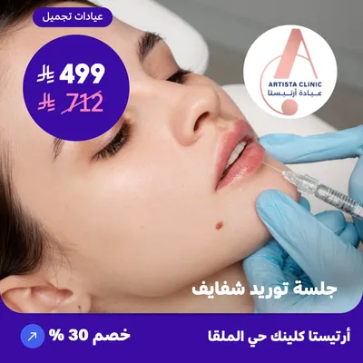 ( احصل على جلسة توريد شفايف ) لدى ارتيستا كلينك حي الملقا