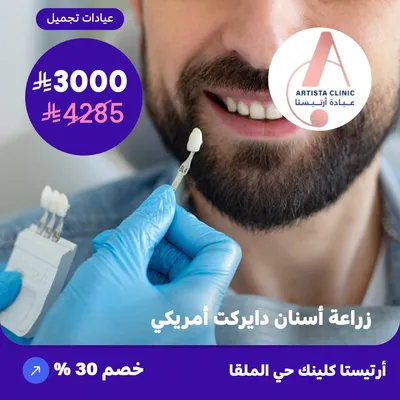 (  احصل على زراعة اسنان دايركت امريكي العرض يشمل سن واحد ) لدى ارتيستا كلينك حي الملقا