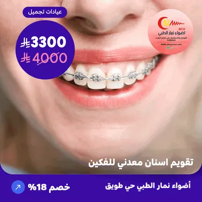 ( احصل على تقويم اسنان معدني للفكين ) لدى اضواء نمار حي طويق